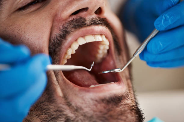Best Emergency Dental Services for Seniors in Clifton, NJ